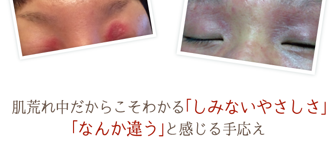 サラヴィオ美容液の「しみないやさしさ」「なんか違う」と感じる手応え