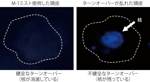 M-1ミストを使用した頭皮