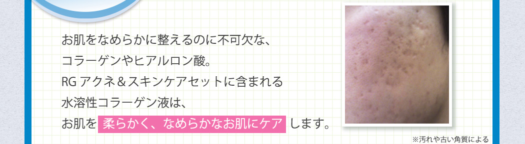 お肌をなめらかに整えるのに不可欠な、コラーゲンやヒアルロン酸。RGアクネ＆スキンケアセットに含まれる水溶性コラーゲン液は、お肌を  柔らかく、なめらかなお肌にケアします。