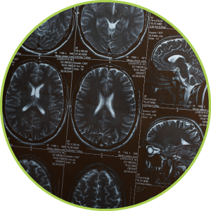 東京大学アルツハイマー共同研究