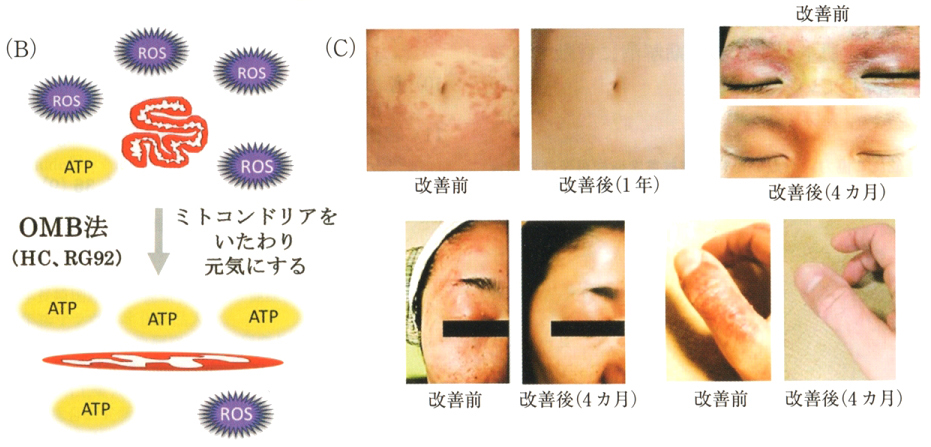 OMB（Onsen Microorganism-Based）法