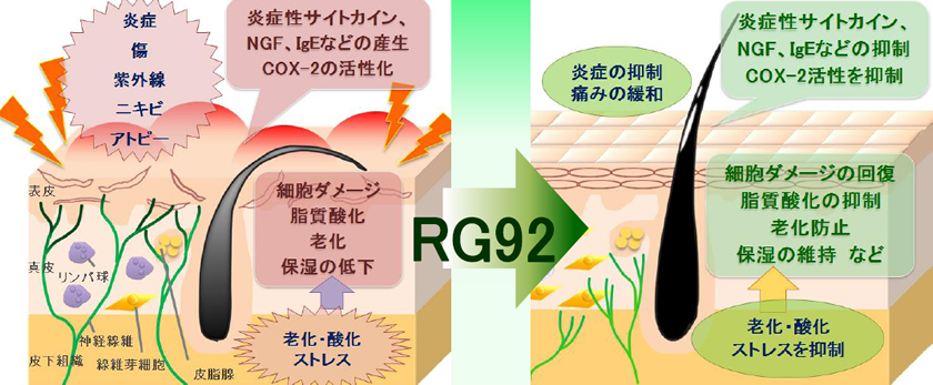 アトピー性皮膚炎の痒みに関与するRG92の効果 