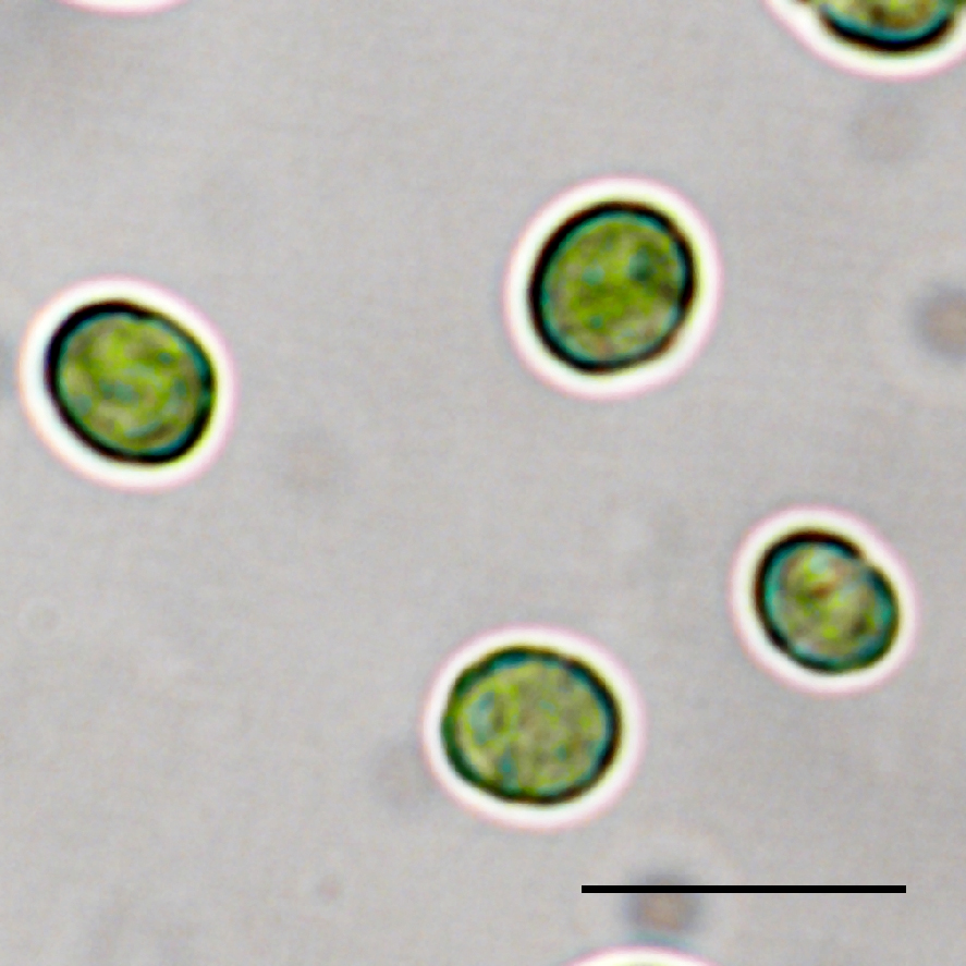 図1 Mucidosphaerium sp. RG92株の光学顕微鏡像