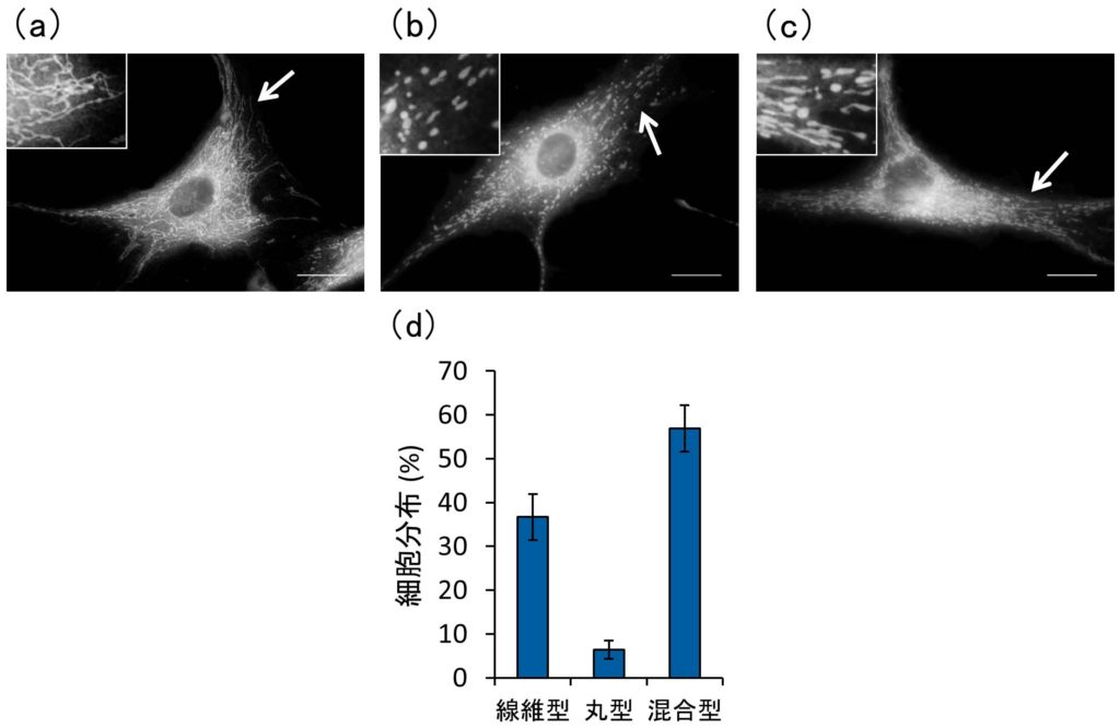 図1　ヒト滑膜線維芽細胞におけるミトコンドリアの形態