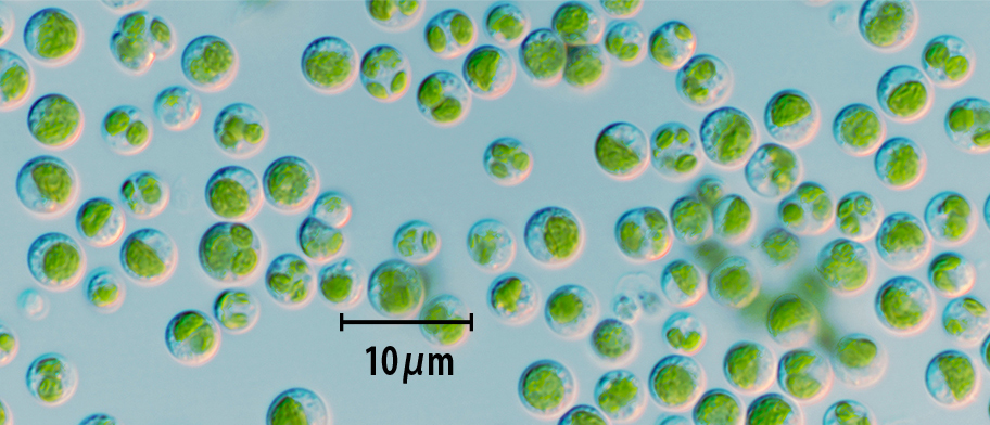 温泉藻類（Mucidosphaerium sp．RG92）の顕微鏡写真