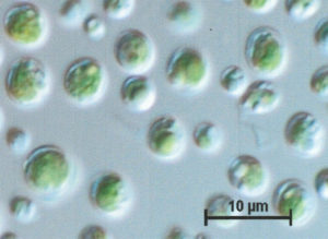 ※温泉藻類　（Mucidosphaerium sp．RG92）の顕微鏡写真